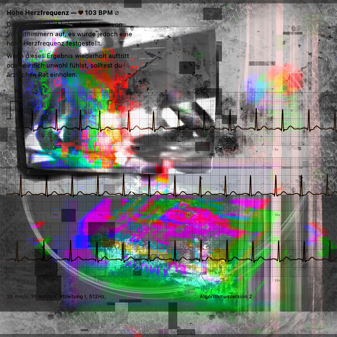 89 sing a quote pt.2 episode artwork