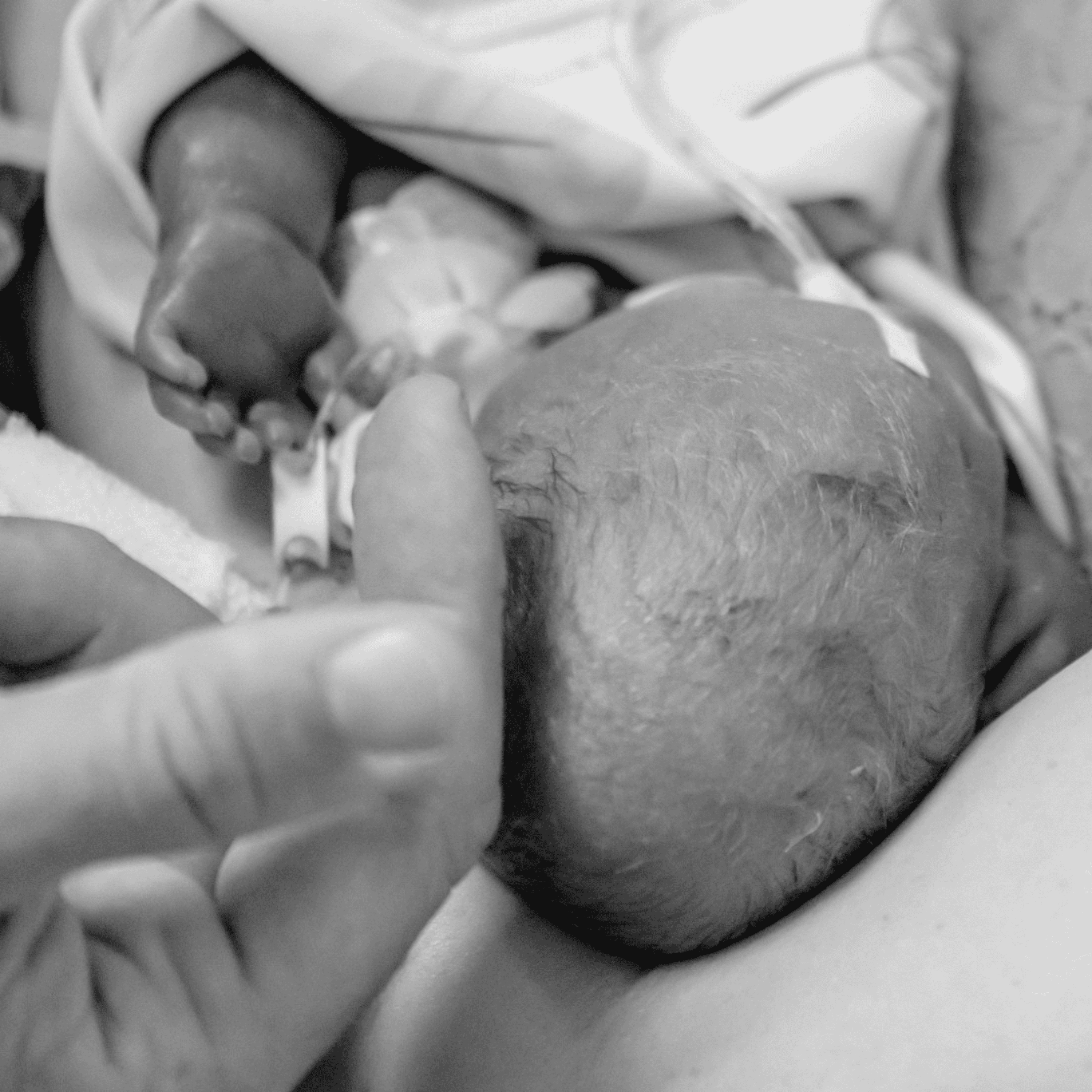 176 | Marianne - Eine Geburtshausgeburt & ein Kaiserschnitt bei 24+4, starke Blutungen, vorzeitiger Blasensprung, Neonatologie, Kindstod episode artwork