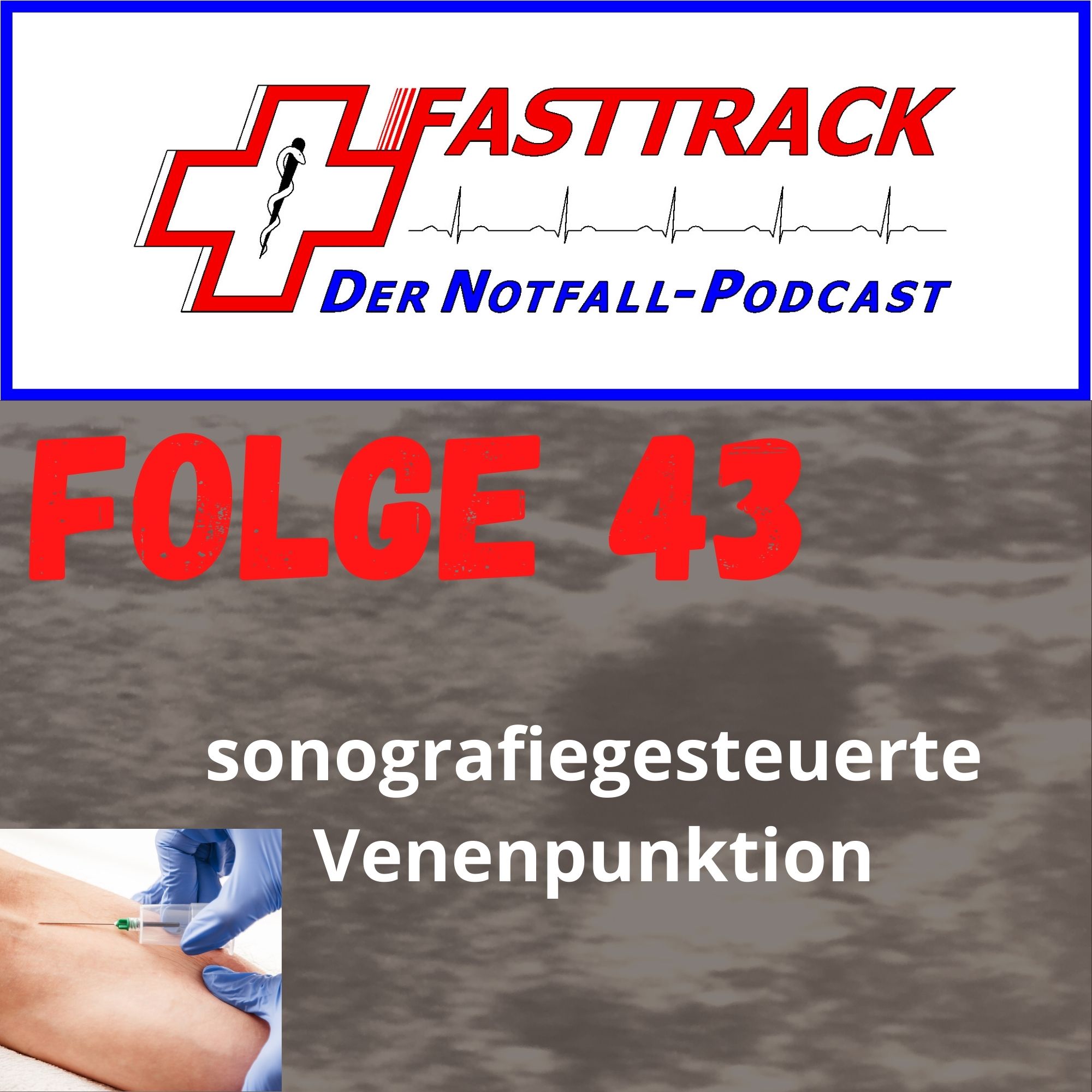 Folge 43