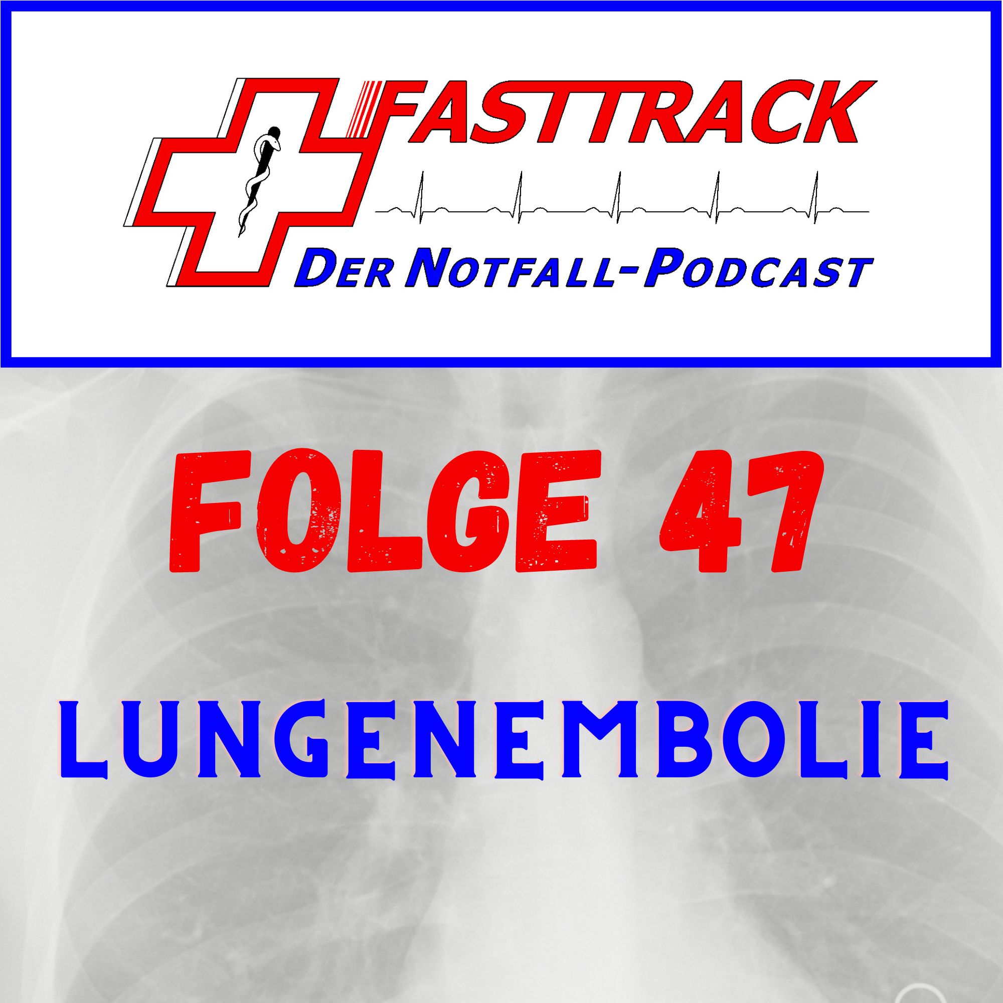 47 - Lungenembolien
