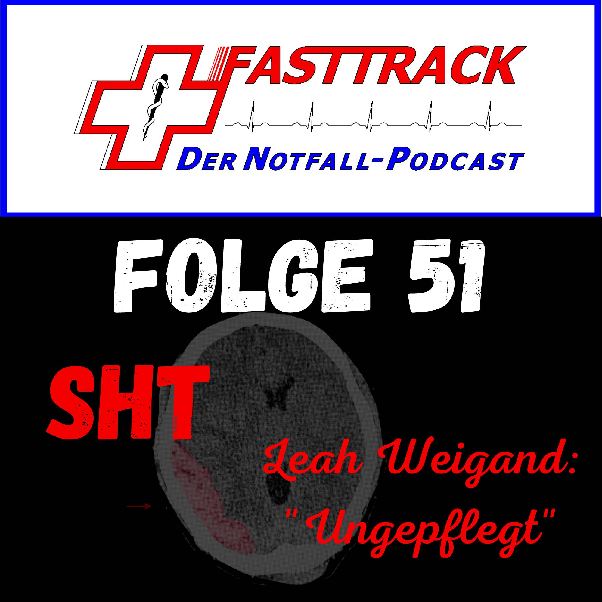 51 - Schädel-Hirn-Trauma und "ungepflegt"