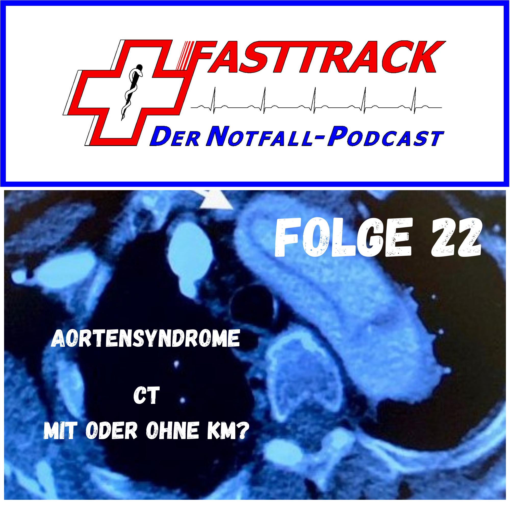 Folge 22