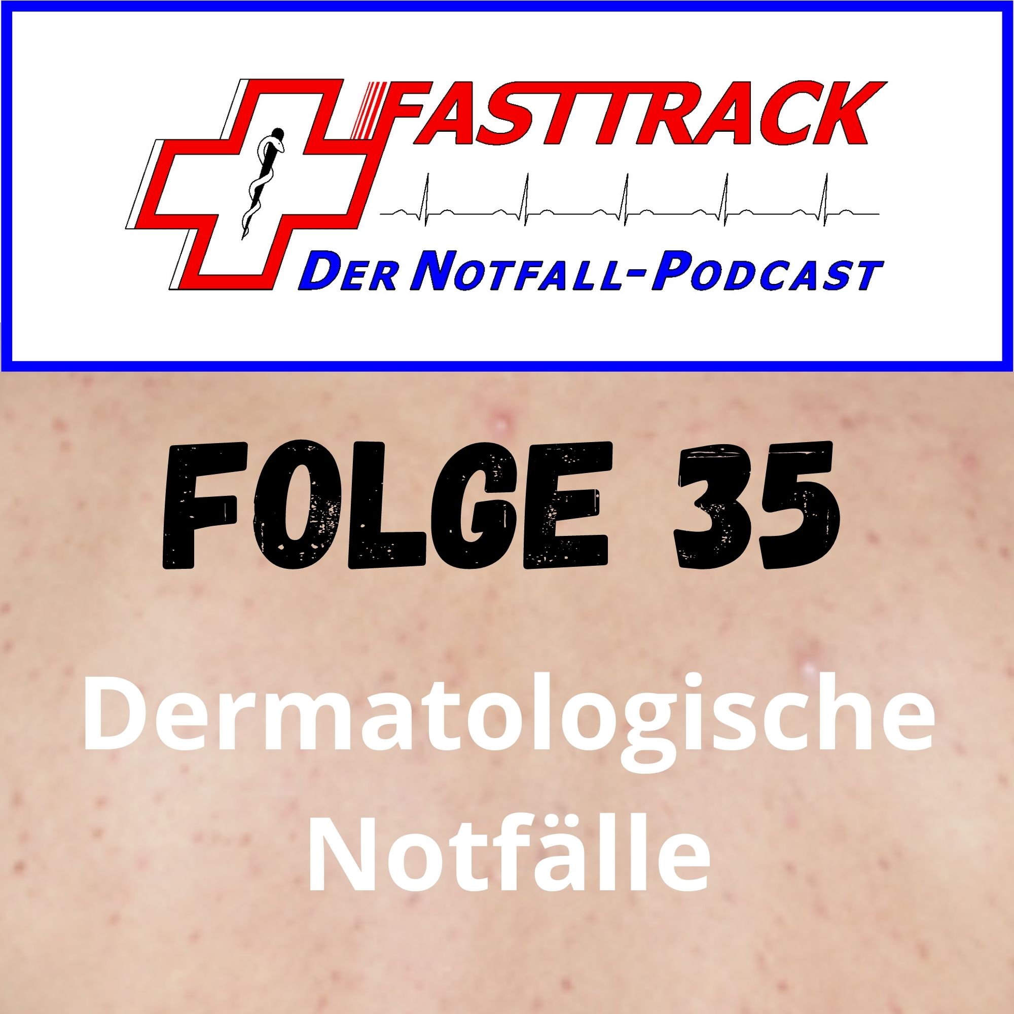 Folge 35 - Dermatologische Notfälle