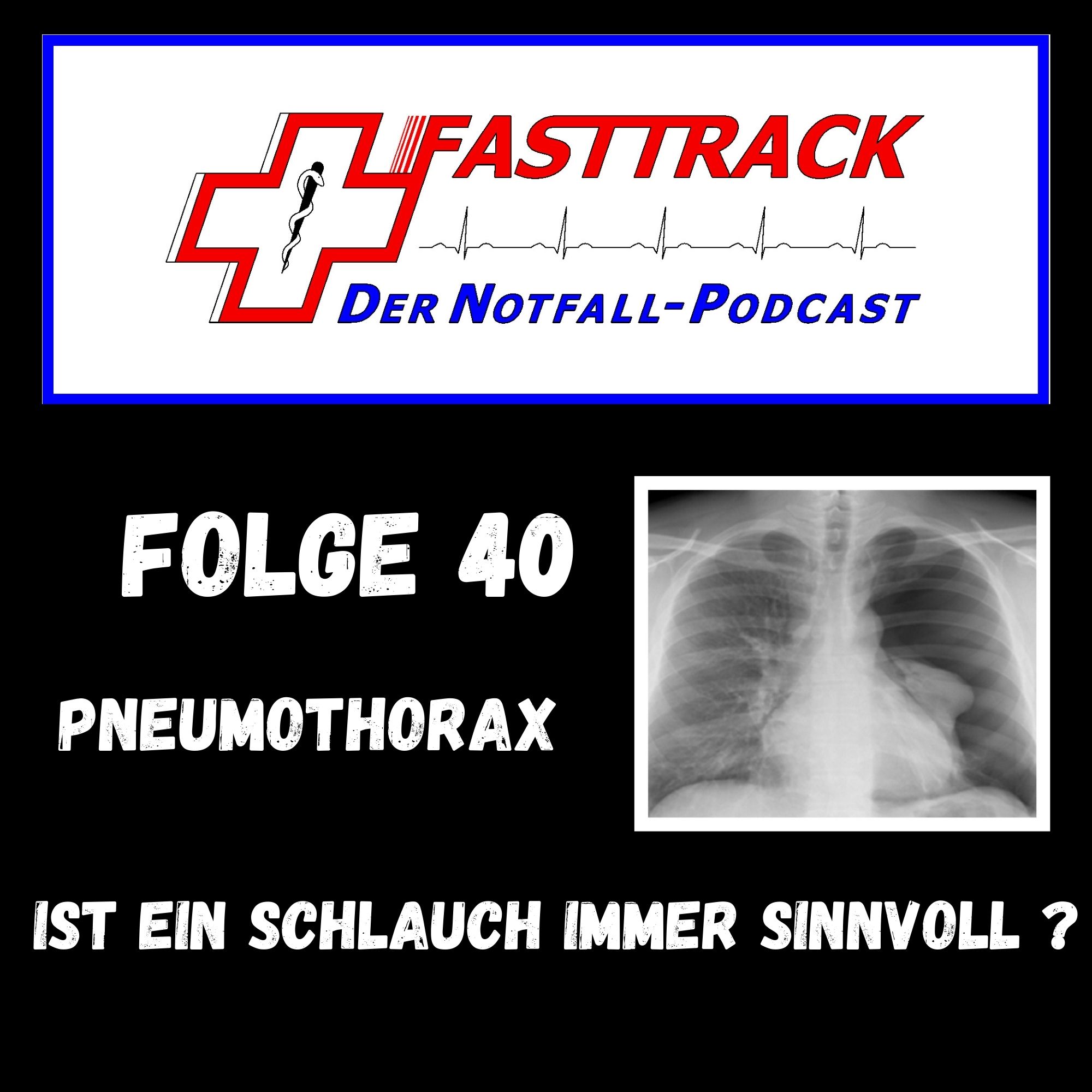 Folge 40