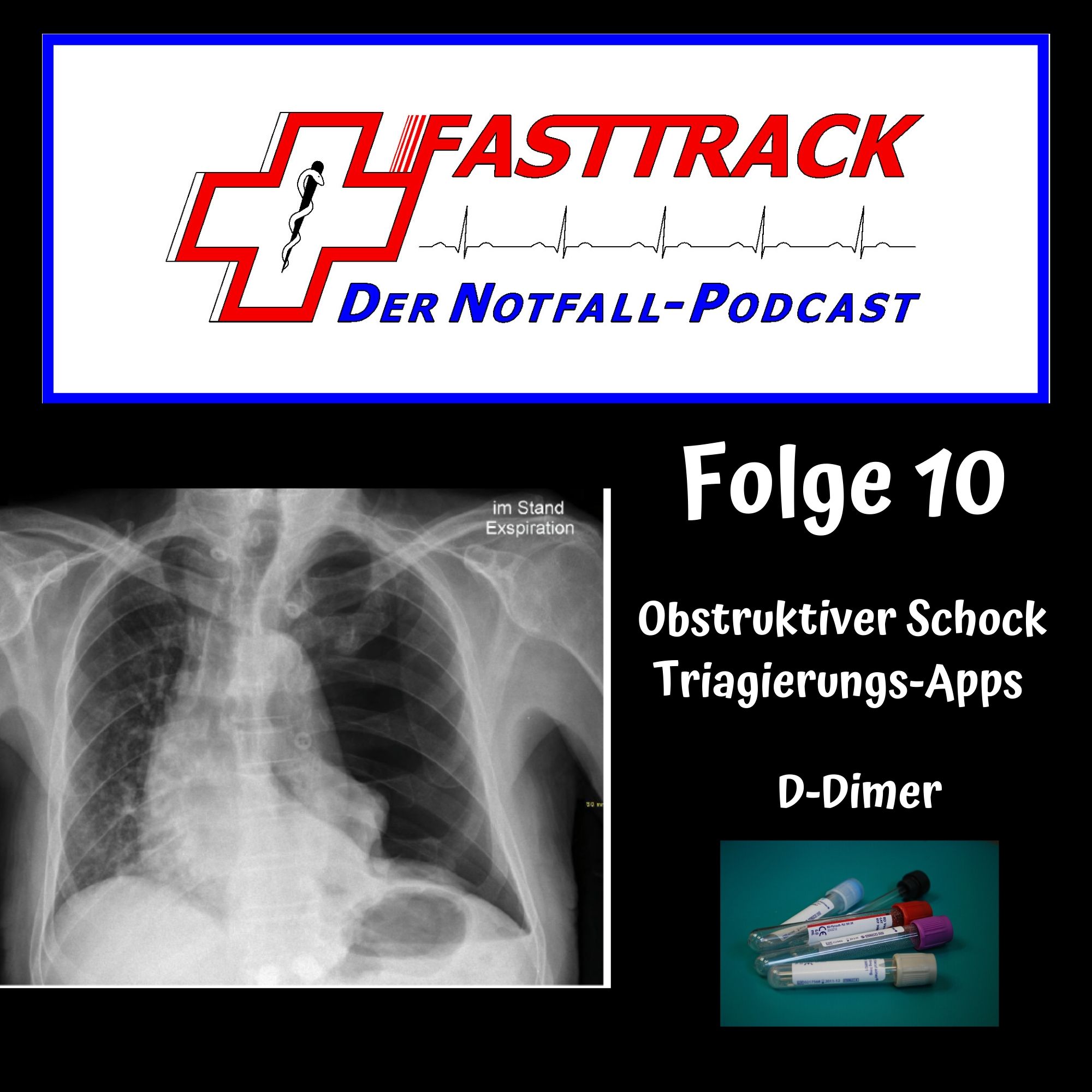 Fasttrack Folge 10