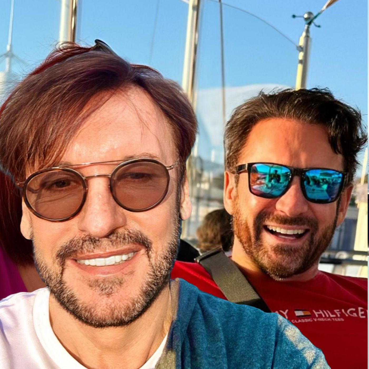 Haartransplantation: Ein umfassender Leitfaden