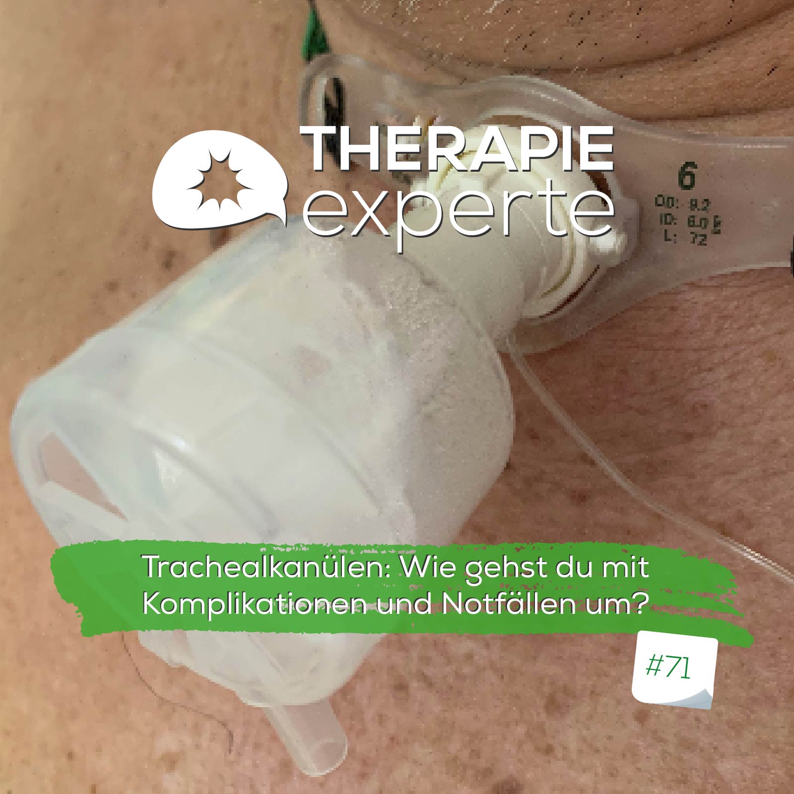 Trachealkanülen: Wie gehst du mit Komplikationen und Notfällen um? episode artwork