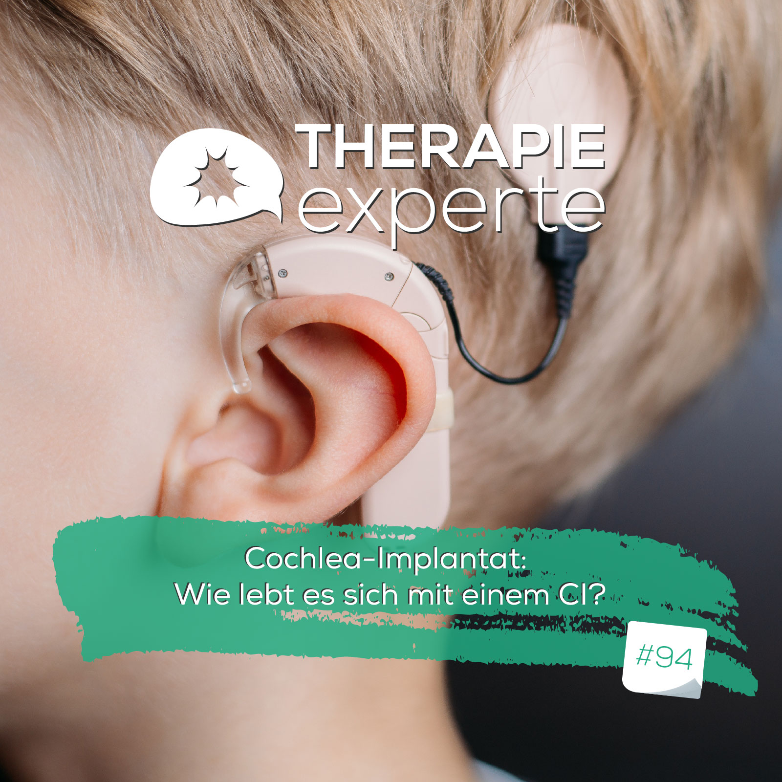 Cochlea-Implantat: Wie lebt es sich mit einem CI? episode artwork